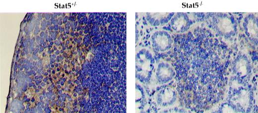 FIGURE 3. Absence of organized PP in Stat5−/− mice. Sectioned intestines stained with anti-VCAM1 mAb (green) show subepithelial stromal cells of PP in WT (left), but not in Stat5−/−, mice (8 wk old). Relatively weakly staining, small VCAM1+ clusters are found in the mucosal layer of Stat5−/− intestines (right). In both samples, cells within the VCAM1+ clusters were positive for IL-7Rα, with stronger staining in the WT intestines (data not shown). Similar results were observed in three animals of each mouse genotype. Magnification, ×200.