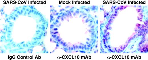 FIGURE 8. Increased CXCL10 expression in the terminal bronchioles of SARS-CoV-infected mice. Images are lung section of a mock and SARS-CoV-infected mouse stained with a mAb directed against CXCL10, images are ×40.