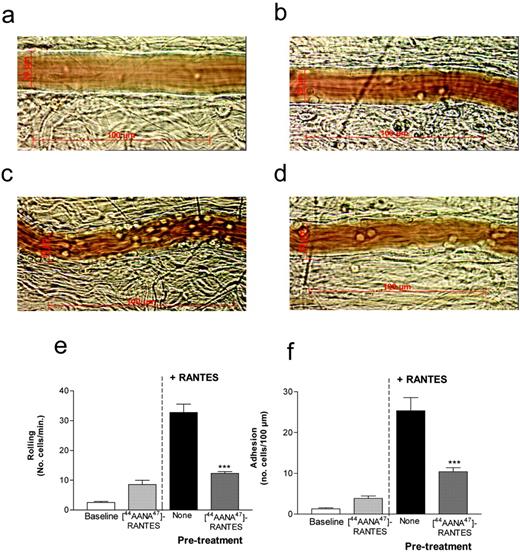 FIGURE 3. Intravital microscopic examination of cellular recruitment by RANTES and [44AANA47]-RANTES. Photographic stills of mesenteric microvessels correspond to on-line supplemental videos 1–4 as follows: a/1, NaCl injection; b/2, [44AANA47]-RANTES injection; c/3, RANTES injection; and d/4, [44AANA47]-RANTES treatment followed by RANTES challenge. Quantitative data from analysis of intravital microscopy of cell rolling (e) and cell adhesion (f).