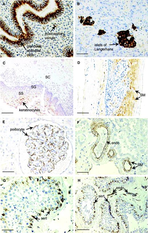 FIGURE 3. Cellular localization of CRIT by immunohistochemistry in various human tissues probed with anti-CRIT-ed2. Proliferating endometrium (A); pancreas (B); esophagus (C and D); kidney (E); venules/arterioles in kidney (F); testis (G and H). Scale bars, F and H, 100 μm; A–E and G, 50 μm. SS, Stratified spinosum; SG, stratified germinativum; SC stratified corneum; SM, smooth muscle; sert, Sertoli cells. Controls that consistently gave no staining (not shown) included omission of primary Ab (anti-ed2) as well as primary Ab absorbed with ed2 peptide. Identical staining patterns in kidney were obtained from at least 10 fresh tissue samples.