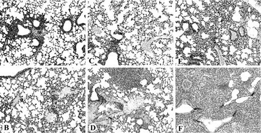 FIGURE 3. Histopathology of the lungs 4, 24, and 48 h after infection with S. pneumoniae. Lungs were excised and fixed in 10% buffered formalin, dehydrated in graded alcohol, and embedded in paraffin. Sections (4 μm) were cut from the paraffin-embedded fixed tissue, mounted on poly-l-lysine-coated slides, and stained with H&E. At least 10 random fields were observed in each section at ×300 magnification using a Zeiss microscope. The representative slides were photographed and are presented: A, section from the lung of a placebo control mouse 4 h after inoculation with S. pneumoniae; B, section from the lung of a morphine-treated mouse 4 h after inoculation with S. pneumoniae; C, section from the lung of a placebo control mouse 24 h after inoculation with S. pneumoniae; D, section from the lung of a morphine-treated mouse 24 h after inoculation with S. pneumoniae; E, section from the lung of a placebo control mouse 48 h after inoculation with S. pneumoniae; F, section from the lung of a morphine-treated mouse 48 h after inoculation with S. pneumoniae.