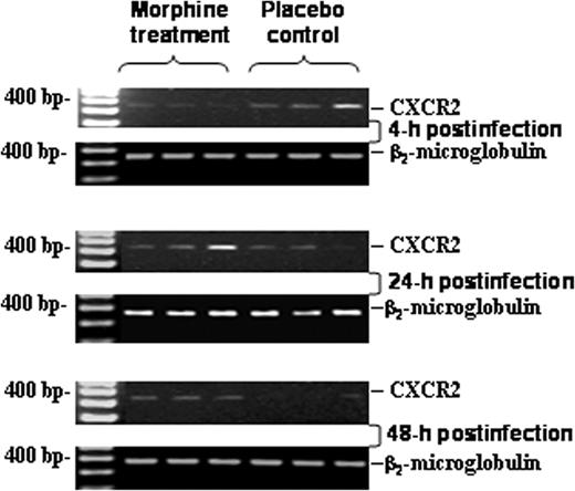 FIGURE 7. Effect of chronic morphine treatment on CXCR2 gene expression in leukocytes derived from BAL fluid. mRNA expression of CXCR2 in leukocyte of BAL fluid was determined by RT and 25 cycles of PCR. RT-PCR results were quantified using Image-Pro Plus software and are presented as a ratio of CXCR2 mRNA/β2-microglobulin mRNA. The results are representative of three independent experiments.