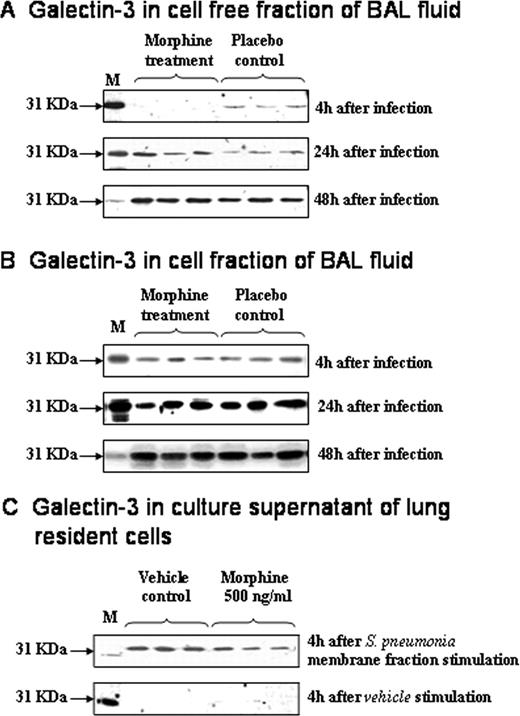 FIGURE 8. Effect of chronic morphine treatment on galectin-3 release in the BAL cell-free fraction (A), synthesis in the BAL cell fraction (B), and release in the culture supernatant (C) of lung resident cells. Levels of galectin-3 were compared by Western blotting. To verify equality of loading, blots were reprobed with anti-tubulin Ab. Shown are representative results from one of three independent experiments.