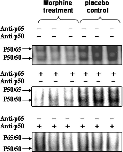 FIGURE 10. Effect of chronic morphine treatment on S. pneumoniae-induced NF-κB activation. The morphine-treated and placebo control mice were killed, and nuclear protein was extracted from lung tissue 2 h after S. pneumonia infection. NF-κB binding was measured in nuclear extracts of lung resident cells by EMSA. The results are representative of three independent experiments.