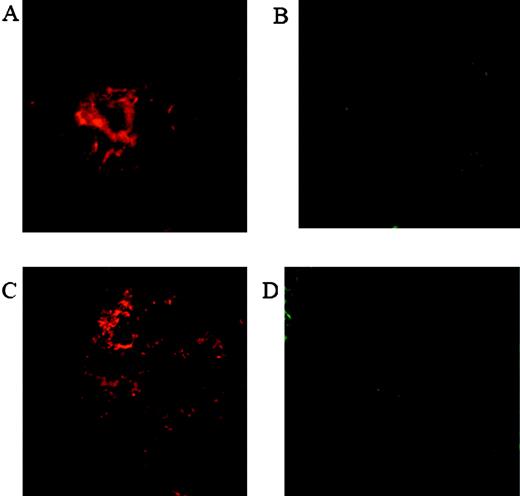 FIGURE 2. Staining for C3 in laser-induced neovascular complex in C57BL/6 and C3−/− mice, 24 h after laser treatment. Purified IgG fraction of goat antiserum to mouse C3 was used as the primary Ab, and Cy3-conjugated anti-goat IgG served as the secondary Ab. A and C, CNV lesions stained red for C3 in C57BL/6 (A) and C3−/− wild-type control mice (C). B and D, No staining for C3 was observed in C57BL/6 mice treated with CVF (B) and C3−/− mice (D) (×2500).
