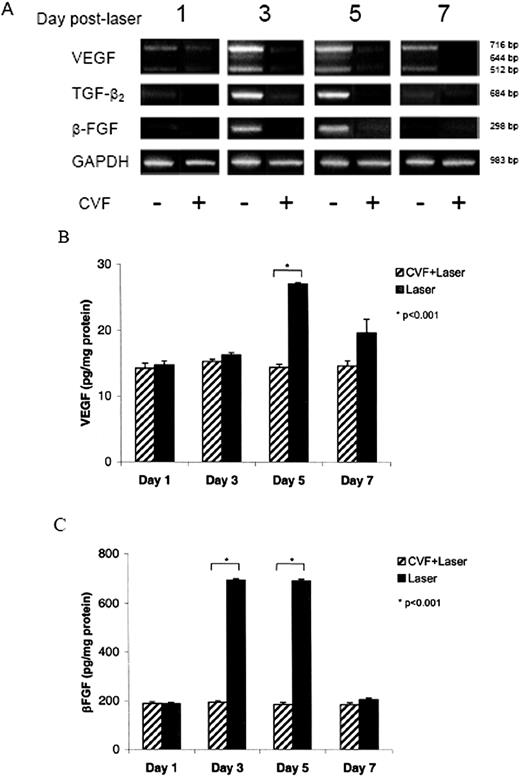 FIGURE 5. Effect of complement on intraocular VEGF, TGF-β2, and β-FGF mRNA expression (A) and protein (B and C) during laser-induced CNV in C57BL/6 mice. A, The figure shows ethidium bromide-stained bands for PCR product after UV exposure. In the presence of complement, VEGF, TGF-β2, and β-FGF transcripts increased at day 3, remained at that level on day 5, and returned to basal levels on day 7. However, in the absence of complement (CVF-treated mice), the levels of these angiogenic factors remained at basal constitutive levels. B and C, Effect of complement on VEGF and β-FGF protein production during laser-induced CNV in C57BL/6 mice. On day 5, the levels of VEGF were significantly increased (p < 0.001) in complement-sufficient mice compared with CVF-treated animals (B). A marked increase (p < 0.001) in β-FGF protein levels was observed on days 3 and 5 in complement-sufficient mice compared with CVF-treated animals (C).