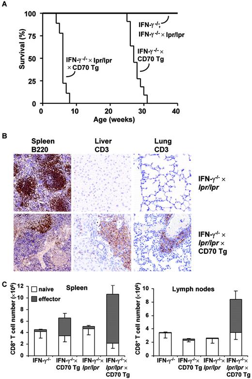 FIGURE 4. Early lethality accompanied with massive effector T cell formation and lymphocytic infiltration into liver and lung of CD95-deficient CD70 Tg mice lacking IFN-γ. A, Accelerated morbidity of CD95-deficient (lpr/lpr) CD70 Tg mice lacking IFN-γ compared with IFN-γ−/− × CD70 Tg mice. B, Disrupted splenic architecture and T lymphocytic infiltrates in liver and lung of IFN-γ−/−× lpr/lpr× CD70 Tg mice compared with IFN-γ−/−, IFN-γ−/−× CD70 Tg, and IFN-γ−/−× lpr/lpr mice. Autopsies were performed and included both gross and microscopic evaluations. Representative sections are shown from spleen, liver, and lung of animals 4 wk of age stained with CD3 or B220 mAbs. C, Absolute numbers of naive (CD62LhighCD43neg/low) and effector (CD62LlowCD43high) CD8+ T cells in spleen and lymph nodes of 4 wk-old IFN−/−, IFN-γ−/−× CD70 Tg, IFN-γ−/−× lpr/lpr, and IFN-γ−/−× lpr/lpr× CD70 Tg mice. Data represent the mean values plus SDs of 4–8 mice.