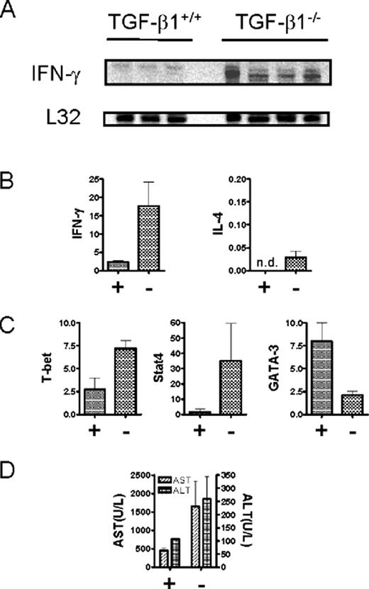 FIGURE 1. Hepatic CD4+ T cells from TGF-β1−/− mice overexpress Th1-specific mRNAs. A, Total liver mRNA was isolated from 11- to 12-day-old BALB/c-TGF-β1−/− (n = 4) or littermate control BALB/c-TGF-β1+/+ mice (n = 3) and probed for IFN-γ (upper panel) and L32 control (lower panel) mRNA expression in an RNase protection assay. A probe for IL-4 showed no band for any of the liver samples (not shown). B, RNA was extracted from magnetic bead-isolated hepatic CD4+ T cells from 11- to 12-day-old BALB/c-TGF-β1−/− mice (−; n = 4) or littermate control BALB/c-TGF-β1+/− mice and BALB/c-TGF-β1+/+ mice (+; n = 3) and analyzed for IFN-γ mRNA and IL-4 mRNA expression levels by quantitative RT-PCR, normalized to β-actin mRNA levels. n.d., none detected. C, CD4+ T cell RNA preparations were analyzed for T-bet mRNA, Stat4 mRNA, and GATA-3 mRNA expression levels by quantitative RT-PCR, normalized to β-actin mRNA levels. D, Plasma samples were obtained from the mice used in B and C, and aspartate aminotransferase and alanine aminotransferase liver enzyme levels were measured. All statistical bars (B–D) show the mean ± SD.