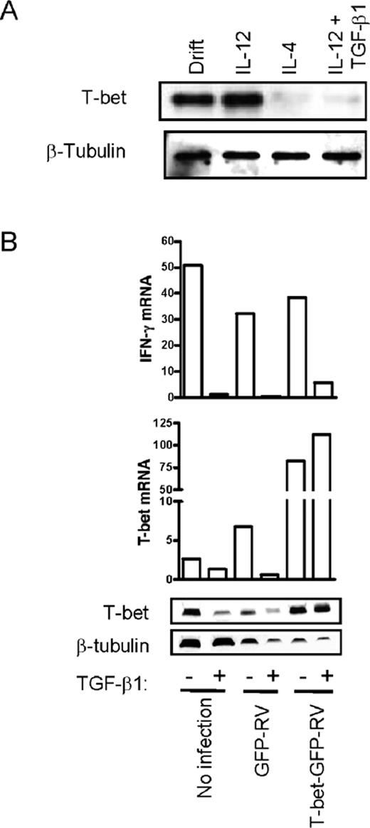 FIGURE 4. TGF-β1-mediated suppression of IFN-γ production at priming does not require T-bet suppression. A, Naive CD4+ T cells were primed with anti-CD3 and anti-CD28 under the conditions indicated, and total protein was collected at 3 days. Western blotting was used to measure protein levels of T-bet (upper panel) and β-tubulin (lower panel). These data are representative of four experiments with similar results. B, Naive CD4+ T cells were primed with anti-CD3 and anti-CD28 mAbs in IL-12 with (+) or without (−) TGF-β1. Additionally, at 24 h, T cells were not infected, were infected with control GFP-RV, or were infected with T-bet-GFP-RV. After 3 days of culture, GFP+ cells were sorted from the retrovirally infected wells, and RNA and protein were collected. IFN-γ (upper panel) and T-bet (lower panel) mRNA levels were measured by quantitative RT-PCR and normalized to β-actin mRNA levels. Western blotting was used to measure T-bet (upper panel) and β-tubulin (lower panel) protein levels.