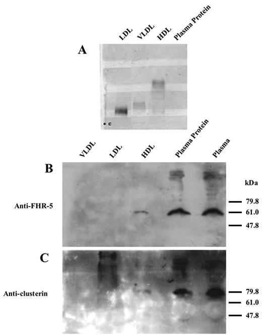 FIGURE 7. Analysis of FHR-5 in lipoprotein complexes. A, Following separation by ultracentrifugation, purity of LDL, VLDL, HDL, and plasma protein fractions was assessed by electrophoresis on a 1% agarose gel and a standard lipid stain. B, Western blot analysis of 10% whole plasma, 10% plasma protein, and ∼50 μg of HDL, LDL, and VLDL nondelipidated lipoprotein fractions. Samples were electrophoresed on 10% SDS-PAGE under nonreducing conditions, and FHR-5 was detected using the mouse anti-human FHR-5 mAb and HRP-conjugated sheep anti-mouse Ig. Delipidated lipoprotein samples gave identical results. C, The Western blot was stripped and reprobed with anti-human clusterin mAb and HRP-conjugated sheep anti-mouse Ig.