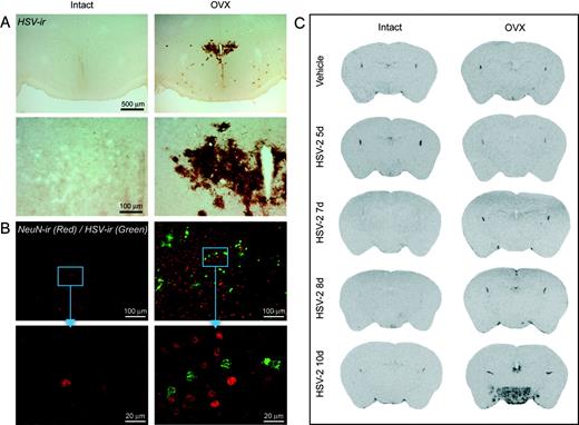 FIGURE 5. Widespread viral replication and inflammation in the brain of OVX mice. Both intact and OVX groups were inoculated intranasally with 20 μl of MEM containing 103 PFU of HSV-2. A, HSV-immunoreactive (ir) neurons in the hypothalamic paraventricular nucleus and the anterior/lateral hypothalamic area of OVX mice 10 days after the intranasal inoculation. B, Laser scanning confocal microscopic image of HSV-immunoreactive (ir) neurons (green, FITC) and the neuronal marker NeuN (red, Alexa Fluor 594). Laser scanning confocal microscopy studies were performed with a ×20 and ×100 Plan-Apo oil immersion objective, numerical apertures 0.8 and 1.35, ×2 numerical zoom with a BX-61 microscope (Olympus America). Emissions were recorded by photomultipliers preset, respectively, for FITC (green pseudo color) and Alexa Fluor 594 (red pseudo color) fluorescent dyes in Fluoview SV500 imaging software. Thirteen 0.5-μm confocal z-series were acquired for each area and corrected by two Kahlman low speed scans. Acquired z-series images were then flattened into one image and exported in 24 bit TIFF format. C, Expression of TLR2 (used as a general index of macrophage/microglia activation) mRNA during the course of HSV-2 replication in the brain of intact and OVX mice is shown. Coronal sections were taken from x-ray films (Biomax; Kodak). Note the strong immunoreactive signal for HSV-2 in the hypothalamic nuclei and areas of OVX animals (A, right column), but not in the rostral brain of intact mice inoculated with the virus (A, left column). These stressed neurons no longer contain nuclear NeuN staining (B, right column). A robust TLR2 transcriptional activation also took place in the mediobasal forebrain of HSV-treated mice devoid of estrogen (C, right column). Such a macrophage/microglial reactivity is a consequence of HSV-induced neuronal damage in the rostral brain of OVX mice (see Results).