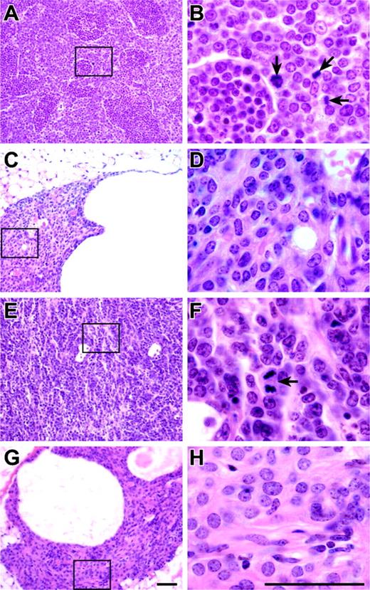 FIGURE 3. Thymi from untreated aged mice (A–D) and from mice irradiated at 10 wk of age with 250 cGy (E–H). Thymic lobe from a NOD-scid mouse at 10 mo of age (A and B) shows thymic lymphoma with numerous mitotic figures (arrows). Thymic lobe from a NOD-scid IL2Rγnull mouse at 16 mo of age (C and D) shows hypoplastic cysts with no evidence of lymphoma. Thymic lobe from a 250-cGy-irradiated NOD scid mouse at 4 mo of age (E and F) shows thymic lymphoma with mitotic figure (arrow). Thymic lobe from a 250-cGy-irradiated NOD-scid IL2Rγnull mouse at 4 mo of age (G and H) showing hypoplasia and cysts with no evidence of lymphoma. Insets on A, C, E, and G show areas magnified at right. H&E. Bars = 50 μm.