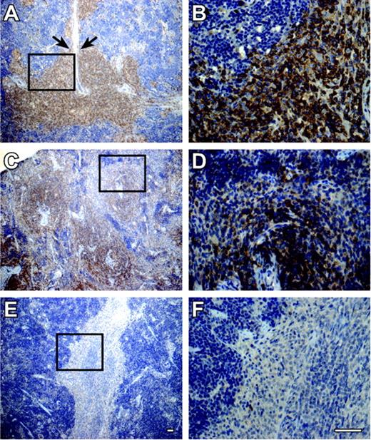 FIGURE 8. Immunoperoxidase staining of human CD45+ cells in sections of spleens from 3-mo-old mice 10 wk after engraftment. (A and B) of NOD-scid IL2Rγnull mouse treated weekly with 20 μg of human Fc-IL7. Note human lymphoid cells in follicles and the presence of human lymphoid cells in the PALS (arrows). C and D, NOD-scid IL2Rγnull mouse. Note human lymphoid cells in follicles. E and F, NOD-scid mouse. A few scattered human lymphoid cells are present. Insets on A, C, and E show areas magnified at right. Bars = 50 μm.