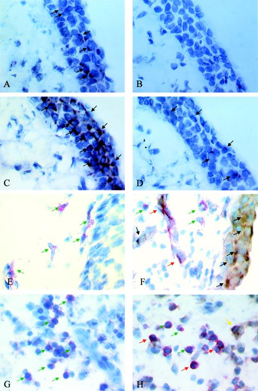FIGURE 1. Typical examples of single ISH, single IHC, sequential ISH/IHC, and double IHC in bronchial biopsies from asthmatics (original magnification, ×1000). A, Single ISH with digoxigenin-labeled TSLP antisense riboprobe; B, control staining with TSLP sense riboprobe; C, TARC/CCL17 antisense riboprobe; D, IP-10/CXCL10 antisense riboprobe; positive cells stain brown/black (highlighted by black arrows). E, Single IHC showing CD31+ endothelial cells. Positive cells stain red (green arrows). F, Sequential IHC/ISH showing single CD31+ endothelial cells (red) (green arrows), single TSLP mRNA+ cells (brown/black) (black arrows), and double TSLP+/CD31+ endothelial cells (red/black) (red arrows). G, Single IHC showing CD4+ cells (red) (green arrows). H, Sequential IHC showing CD4+/CCR4+ cells (red/brown) (red arrows), and single-positive CD4+ cells (red) (green arrows) and CCR4+ cells (brown/black) (yellow arrow).