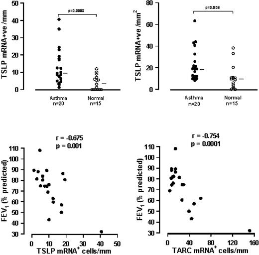 FIGURE 2. Numbers of cells expressing TSLP mRNA in the epithelium (positive cells/mm length of basement membrane; top left) and submucosa (positive cells/mm2 of submucosa; top right) of bronchial biopsies from asthma and normal controls, and correlations between FEV1 and epithelial expression of TSLP (bottom left) and TARC/CCL17 (bottom right) mRNA+ cells in asthmatics.