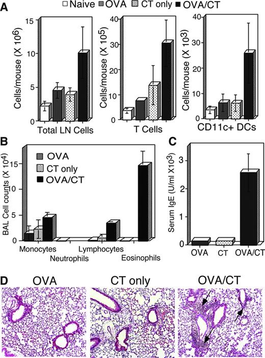 FIGURE 1. CT combined with OVA induces airway inflammation. Animals were given three daily consecutive intranasal treatments with OVA alone or combined with CT. These treatments were followed after 5 days by seven daily treatments with aerosolized OVA. A, Lymph node cell counts 1 day after the three intranasal OVA, CT alone, or OVA/CT instillation treatments. Naive animals were age-matched but received no treatments. Data shown are the mean ± SD of at least three experiments. B, Differential cell counts in the bronchoalveolar lavage of animals following intranasal treatments and aerosol challenge. Three hundred total cells were counted per sample, and the proportions obtained were used to calculate the number of cells per animal. Data shown are the mean ± SD of at least three to five animals per group. C, OVA-specific serum IgE as determined by ELISA. Data shown are the mean ± SD of at least three to five animals per group. D, Histology showing inflammation around bronchovascular bundles in OVA/CT-treated (arrows) but not in OVA- or CT-treated animals. Data are representative of at least three independent experiments.