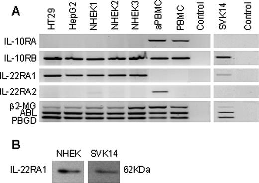 FIGURE 2. Expression of the IL-22RA1 membrane receptor by NHEK and keratinocyte cell line SVK14. A, Total RNA was extracted from NHEK of three independent donors and from the keratinocyte cell line SVK14. RT-PCR was performed with specific primers for IL-10RA, IL-10RB, IL-22RA1, IL-22RA2, β2-microglobulin (β2-MG), PBGD, and abelson kinase (ABL) genes. PCR products were analyzed by agarose gel electrophoresis. The hepatoma cell line HepG2, the colorectal cell line HT29, and the activated human PBMC were used as positive controls. B, Twenty micrograms of cell lysate from NHEK and keratinocyte cell line SVK14 were separated by SDS-PAGE (10%) and transferred to nitrocellulose membrane. Detection of a 62-kDa IL-22RA1 band was assessed by Western blot analysis (representative of three independent experiments).