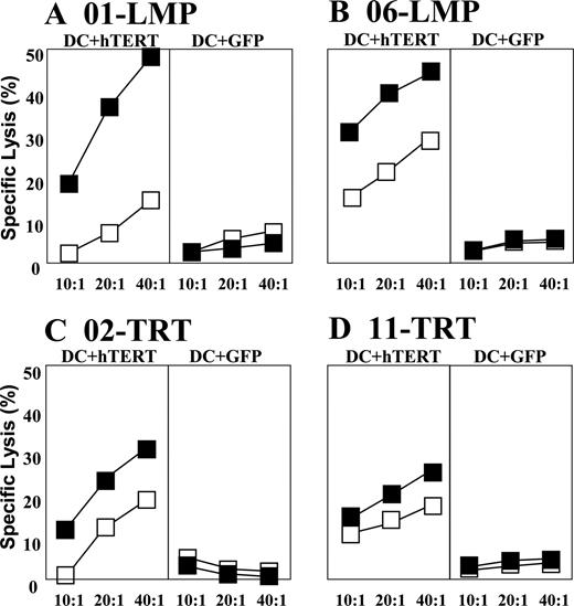 FIGURE 3. Cytolytic function of vaccine-induced, hTERT-specific T cells. PBMC obtained from four study subjects (01-LMP (A); 06-LMP (B); 02-TRT (C); 11-TRT (D)) who received three weekly doses of hTERT- or LAMP hTERT mRNA-transfected DC were restimulated twice to generate CTL. The efficacy of CTL generated from pretherapy (□) and posttherapy (▪) PBMC samples was compared in standard cytolytic assays. As targets, hTERT- or GFP mRNA (control)-transfected DC were used.