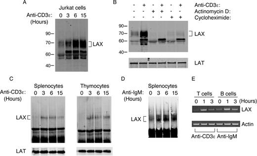 FIGURE 1. Up-regulation of LAX protein upon lymphocyte activation. A, Jurkat cells were stimulated with anti-CD3ε Ab (OKT3) for 0, 3, 6, and 15 h before lysis. Lysates were immunoprecipitated with rabbit anti-LAX serum. Immunoprecipitates were analyzed by Western blotting with anti-LAX mAb. B, Jurkat cells were either unstimulated (−) or stimulated with OKT3 for 6 h (+) in the presence of actinomycin D or cycloheximide. Immunoprecipitation and Western blotting were performed as described in A. Whole cell lysates were blotted with anti-LAT serum to indicate that equal amounts of proteins were used in immunoprecipitation. C, Up-regulation of LAX in mouse splenocytes and thymocytes. Splenocytes and thymocytes were stimulated on anti-CD3ε-coated plates for 0, 3, 6, and 15 h before lysis. The lysates were immunoprecipitated with anti-mouse LAX mAbs, followed by Western blotting with polyclonal anti-LAX Ab. The lysates were also analyzed by an anti-LAT Western blot. D, Up-regulation of LAX after anti-IgM stimulation. Mouse splenocytes were stimulated with anti-IgM F(ab′)2 for 0, 3, 6, and 15 h before lysis. Immunoprecipitation and Western blotting were performed as described in C. E, RT-PCR for quantitation of the LAX transcript. RNAs from splenic T and B cells activated for 0, 1, and 3 h were used in RT-PCR with LAX and actin-specific primers.