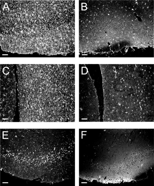 FIGURE 5. Detection of activated microglia (A–D) and COX-2 (E and F) induction in brain sections from N. meningitidis-infected CD46 transgenic mice (A, C, and E) and noninfected mice (B, D, and F). Following i.p. injection with wild-type N. meningitidis FAM20, CD46 transgenic mice were perfused with fixative at different time points. Brain sections were stained for microglia and COX-2 as described in Materials and Methods. Microglia cells in the piriform cortex of CD46 transgenic mice (A) and noninfected mice (B) 6 h postchallenge. Microglia cells in striatum of CD46 transgenic mice (C) and noninfected mice (D) 6 h postchallenge. E, COX-2-expressing cells in the piriform cortex in CD46 transgenic mice 6 h postchallenge with FAM20. F, COX-2 expression in noninfected CD46 mice. White bar, 50 μm.