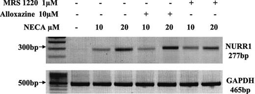 FIGURE 8. The stimulatory effects of high-dose adenosine on NURR1 mRNA levels are not mediated through type A2B or A3 adenosine receptors. Representative RT-PCR products generated following amplification of mRNA from primary synoviocytes with NURR1- and GAPDH-specific primers. Primary synoviocytes were either left untreated or incubated for 2 h with NECA 10 μM or 20 μM in the presence or absence of alloxazine (10 μM) or MRS 1220 (1 μM). The m.w. markers are shown on the left.