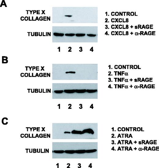 FIGURE 5. sRAGE and anti-RAGE inhibit CXCL8- and TNF-α- but not ATRA-induced type X collagen expression. Primary normal human knee articular chondrocytes (donor ages, 29–62) (5 × 105 cells/six-well dish) were stimulated with CXCL8 (A), ATRA (B), or TNF-α (C) in the presence or absence of 1 μg/ml sRAGE or 20 μg/ml anti-RAGE. SDS-PAGE and Western blotting analysis for type X collagen were performed on cell lysates at 5 days in culture. These data are representative of results from six normal human donors.