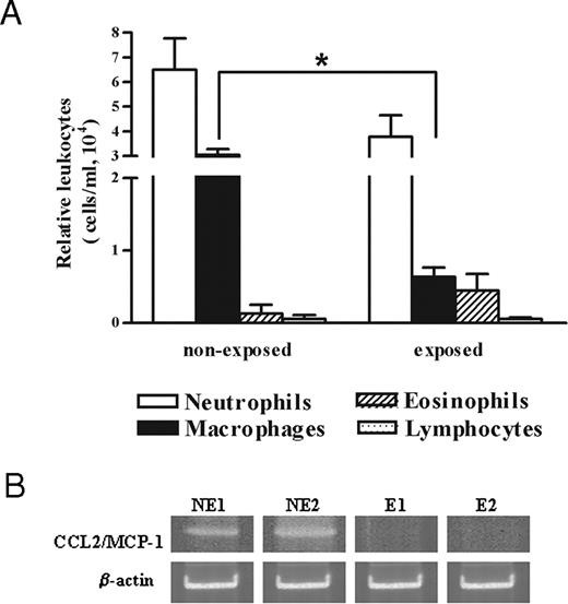 FIGURE 6. Inhibition of SGH effect in vivo in BALB/c mice (n = 6) sensitized with bites from L. longipalpis. A, BALB/c mice were exposed five times to L. longipalpis bites (10-day intervals) or nonexposed. Ten days after the last exposure, air pouches were induced and stimulated with SGH. Significant difference (∗, p = 0.0366) from macrophage recruitment value is represented for nonexposed and exposed group. B, RT-PCR analysis of CCL2/MCP-1 from nonexposed (NE) and exposed (E) BALB/c air pouch lining tissue 12 h after SGH (0.5 pair/animal) stimulation. The results are representative of three experiments.