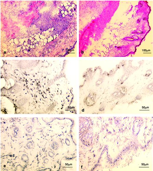 FIGURE 5. Histological evaluation of murine air pouches. Ten-micrometer cryostat sections of dissected air pouches were prepared 24 h after chemokine administration. a, c, and e, Sections taken from mice injected with wt CCL7; b, d, and f, sections from mice injected with non-GAG-binding mutant CCL7. Sections were stained with H&E (a and b), or labeled with Ab to identify CD3+ T cells (c and d) or Ab to identify F4/80+ mononuclear phagocytes (e and f).
