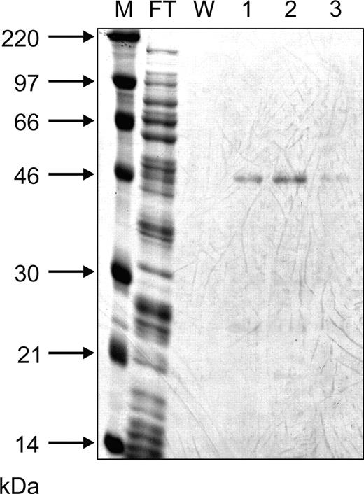 FIGURE 2. Expression and purification of His-tagged recombinant Hom s 4 via nickel affinity chromatography. A molecular mass marker (lane M), the flow-through (lane FT), the wash solution (lane W), and the eluted fractions (lanes 1–3) were separated by SDS-PAGE and stained with Coomassie blue. Molecular masses (in kilodaltons) are indicated on the left margin.