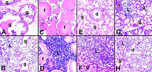 FIGURE 6. Organ-specific autoimmune disease in d3tx mice. A complete autopsy was performed at the time of death, and organs were studied by histopathology. Photomicrographs are of prostate (A and B), thyroid (C and D), salivary gland (E and F), and lacrimal gland (G and H) from sham-tx mice (A, C, E, and G) with normal glands (g), follicles (f), and ducts (d). The bottom panel (B, D, F, and H) shows lymphocytic infiltration (L) with destruction of normal architecture in d3tx mice. Lung, liver, stomach, small intestine, adrenal gland, ovary, testes, and heart did not show inflammatory changes.