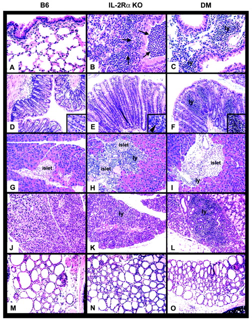 FIGURE 4. Histological examination of tissues from B6, IL-2Rα KO, and DM mice. Various tissues were fixed in 10% neutral buffered formalin, paraffin embedded, and sectioned, and 4-μm sections were stained with H&E. Lung (A–C), colon (D–F), pancreas (G–I), lacrimal glands (J–L), and thyroid (M–O) are shown. Lymphocytic infiltration (ly) seen in IL-2Rα KO and DM mice is indicated. IL-2Rα KO mice have a strong neutrophil infiltration (arrows) in the lungs and bronchiolar lumen exudate (B). Arrow in inset in E shows a multinucleated giant cell seen in the colonic mucosa of IL-2Rα KO mice. Photomicrographs were taken at ×200 for lung (A–C) and colon (D–F). All other photomicrographs were taken at ×100 magnification. Little or no infiltration was observed in tissues of control B6 mouse.
