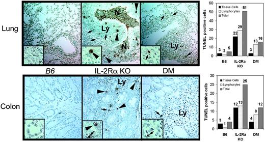 FIGURE 5. Fas mutation protects cell death in the inflamed lung and colon of IL-2Rα KO mice. Sections of lung (top panels) and colon (bottom panels) were stained for apoptotic cells by TUNEL assay. TUNEL+ cells as indicated by dark brown color were more frequent in the IL-2Rα KO mice than DM mice (×100). The inset captured at ×400 magnification shows the apoptotic cell types. Both apoptotic leukocytes (arrows) and apoptotic tissue cells (arrowheads) were observed. (Ly, lymphocyte; N, neutrophil). The bar graphs (right panels) show the numbers of TUNEL+ tissue cells, TUNEL+ lymphocytes, and total apoptotic cells in the inflamed tissues. A total of five randomly selected fields were counted for each sample at a magnification of ×200. The tissue apoptotic cells were distinguished from apoptotic lymphocytes on the basis of the size of the nucleus and surrounding cytoplasm.