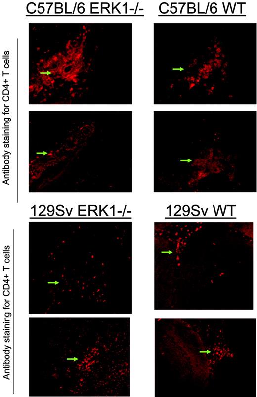 FIGURE 6. CD4+ T cells infiltrate into the CNS to a similar extent in ERK1−/− and WT mice. The 6- to 8-wk-old C57BL/6 or 129 Sv ERK1−/− or WT mice were immunized with MOG35–55 in CFA and PT and observed for clinical signs of EAE. At the peak of disease, brains of the mice were removed and stained with anti-CD4-PE-labeled mAbs and evaluated by immunofluorescence microscopy. Shown are representative sections of ERK1−/− (left panels) or WT brain tissue (right panels) of C57BL/6 (top half) or 129 Sv (bottom half) mice with EAE. CD4+ T cells are indicated by arrows.