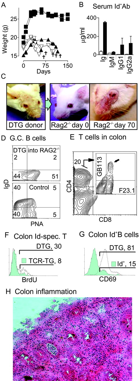 FIGURE 8. Transfer of disease with doubly transgenic T and B lymphocytes. A, Weight development and death (†) of Rag2−/− recipients that had received B220+ B cells (2 × 106) alone (▪), Thy1+ T cells plus B220+ B cells (8 × 105 and 2 × 106, respectively) (▿), or unfractionated cells (5 × 106) (▵) from donor doubly transgenic lymph nodes and spleens. B, Serum Id+ Ig in Rag2−/− recipients of sorted B cells alone (□) or recipients of sorted T and B cells (▪). C, Doubly transgenic Thy1+ T cells and B220+ B cells as described in A were injected into a BALB/c Rag2−/− recipient. Skin disease of donor (left), recipient on day 0 (middle), and same recipient on day 70 (right) are photographed. D, Increase in splenic germinal center (G.C.) B cells (IgD−PNA+) in Rag2−/− recipients of doubly transgenic T and B cells, compared with an Id+ control mice. E, Id-specific T cells in recipient IBD-affected colon 70 days after transfer. Gated CD4+CD8− cells were analyzed for transgenic TCR expression in the inset GB113-F23.1 plot, Id-specific CD4+ T cells expressing both transgenic α- and β-chains are in upper right quadrant (inset, arrow). F, Proliferation in vivo (BrdU incorporation) of gated CD4+GB113+ colon T cells from a diseased Rag2−/− recipient 70 days after transfer (open histogram) compared with singly TCR transgenic mouse (filled histogram). G, CD69 expression of gated Id+ MHC class II+ B cells in Rag2−/− recipient (open histogram) or singly Id+ transgenic mouse (filled histogram). H, Inflammation with lymphocyte infiltration in colon of Rag2−/− recipient of Id+ B cells and Id-specific T cells. H&E stain.