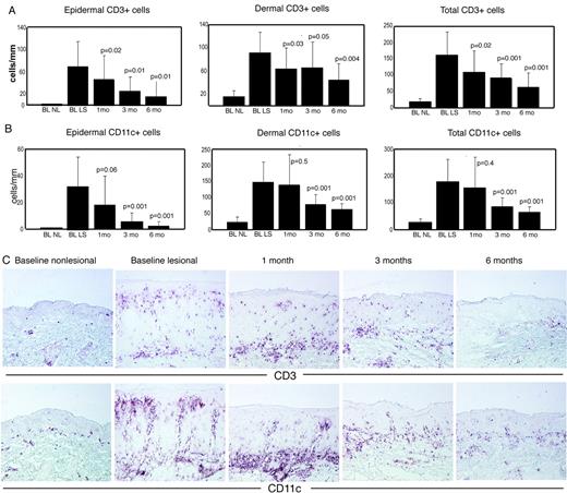 FIGURE 2. Decreased cellular infiltration in epidermis and dermis of psoriasis plaques in response to etanercept treatment. CD3+ cells (A) and CD11c+ cells (B) at baseline nonlesional (BL NL), baseline lesional (BL LS), and 1, 3, and 6 mo of treatment. C, Representative photomicrographs of CD3+ and CD11c+ immunostained frozen skin sections from a patient responding to etanercept, showing gradual reversal of CD3+ and CD11c+ cells infiltrating psoriasis lesions (×10). Comparison of results in treatment groups to lesional results, p value indicated.