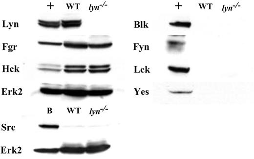 FIGURE 1. Expression of Src family kinases in WT and lyn−/− DCs. WT and lyn−/− BMDCs were purified from 8-day cultures. The expressions of Hck, Fgr, Lyn, Src, Lck, Fyn, Blk, and Yes were determined by immunoblotting. The expression level of Erk2 represented the loading control. +, WT splenocyte and lymph node cell lysates (as a positive control); WT, WT BMDC lysate; lyn−/−, lyn−/− BMDC lysate; B, brain cell lysate (as a positive control for Src). Data shown are representative of at least two independent experiments.