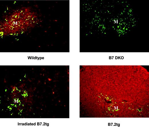 FIGURE 3. Thymic B7-2 expression patterns in wild-type, B7-1/B7-2 KO, irradiated B7-2-transgenic (tg), and B7-2-tg mice. Sections of frozen thymus tissue from 7- to 14-wk-old mice or from an irradiated B7-2-tg mouse 7–14 days after reconstitution with CD28.FL-tg bone marrow were stained with anti-B7-2. Medullary regions of the thymus are identified by staining with anti-keratin 14 and are identified in the figure with an “M.” B7-2 reactivity was detected with Texas Red-conjugated anti-Ig, and keratin 14 reactivity was detected with FITC-conjugated anti-Ig as described in Materials and Methods.