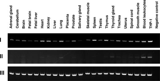 FIGURE 2. Expression of cysLT1R mRNA spliced transcripts in human tissues. Panels represent RT-PCR products specific for spliced cysLT1R transcripts and β-actin. I, cysLT1R transcript I; II, cysLT1R transcript II; III, control β-actin transcripts.