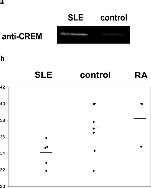 FIGURE 5. Increased CREM binding to the TCR ζ promoter in SLE T cells. T cells from SLE patients and normal controls were fixed with formalin, washed, lysed, and sonicated. The DNA-protein complexes were immunoprecipitated with anti-CREM Ab and extracted by protein A/G agarose-Sepharose beads. The DNA was purified and amplified with primers flanking the TCR ζ promoter, including the −390 CRE site, by real-time PCR. DNA from 1 × 106 cells was used for each PCR. a, Representative experiment that was run on a 1.5% agarose gel; b, the threshold cycle values from five SLE patients, seven control individuals, and three patients with rheumatoid arthritis. Horizontal lines depict mean values.