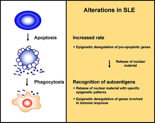 FIGURE 2. Scheme depicting the model of the two major alterations in SLE patients in association with epigenetic events that explain the presence of autoantibodies: increased rate of apoptosis in circulating lymphocytes and abnormal recognition of nuclear autoantigens released during apoptosis. The box on the right side includes epigenetic events that are proposed to participate in SLE.