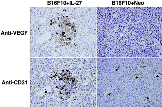 FIGURE 4. Suppression of neovascularization by IL-27 in lung metastasis. WT mice were injected i.v. with B16F10 + IL-27 or B16F10 + Neo cells, and after 3-wk formalin-fixed lung sections of each mouse were prepared and stained with anti-VEGF or anti-CD31 using a standard avidin-biotin immunoperoxidase method. Arrowheads indicate CD31-positive vessels. Note: Dark brown particles in tumor cells are pigments from melanoma cells.