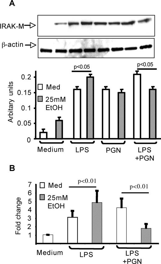 FIGURE 4. Effect of alcohol on IRAK-M protein and mRNA levels in TLR2- and/or TLR4-stimulated monocytes. A, Normal human monocytes were stimulated for 12 h as described in Materials and Methods, and total protein extracts (30 μg) were subjected to Western blot analysis with an IRAK-M Ab. β-Actin was used as a loading control. Densitometric analysis of six different experiments normalized to β-actin is shown. The data are represented as mean ± SE (n = 6). B, Normal human monocytes were stimulated for as indicated in the graph for 6 h, and total RNA was extracted as described in Materials and Methods. The ratio of IRAK-M:18S mRNA expression was determined by real-time quantitative PCR using the iCycler system. The graph represents the fold change in IRAK-M:18S ratios as compared to the unstimulated cells. Mean ± SE of a total of three experiments performed are depicted.