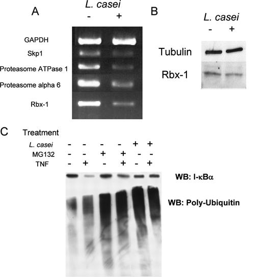 FIGURE 7. L. casei induced a down-regulation of genes involved in ubiquitination/degradation processes. Caco-2 cells were cultured overnight with L. casei with a MOI of 100. A, After washes with PBS and RNA extraction with the Rneasy mini kit, cDNA was synthetized using oligo-d(T) and reverse transcriptase. PCRs were performed as described in the legend to Fig. 2. B, After washes with PBS and lysis with Laemmli buffer, aliquots of the lysates were loaded on 15 or 10% SDS-PAGE for the subsequent detection of Rbx-1 or tubulin, respectively. The Rbx-1 or tubulin protein contents were determined by Western blotting using a polyclonal anti-human Rbx-1 or a monoclonal anti-human tubulin Ab, respectively. C, HEK cells were treated overnight with L. casei or for 6 h with 50 μM of the proteasome inhibitor MG-132 before incubation with or without TNF. The I-κBα protein content and global ubiquitinated proteins were determined by Western blotting (WB) using a polyclonal anti-human I-κBα Ab or monoclonal anti-ubiquitin Ab, respectively.