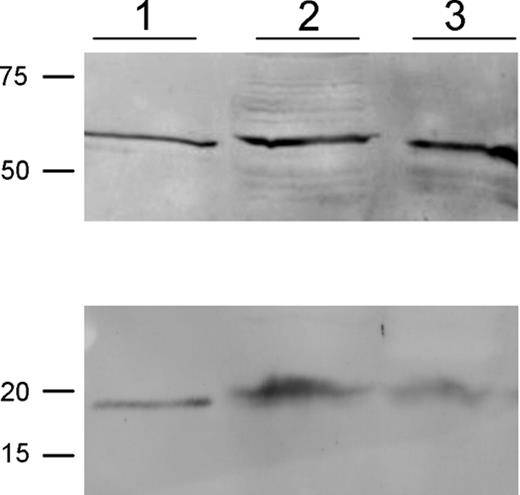 FIGURE 2. IL-23 heterodimer is expressed by human keratinocytes at protein level. Normal human keratinocytes were stimulated overnight with poly(I:C) and IFN-γ. The supernatants and the cell lysates were subjected to SDS-PAGE and Western blot analysis under nonreducing (top) and reducing (bottom) conditions. Recombinant human IL-23 heterodimer (100 ng) (lane 1), cell lysate (lane 2), and 20-fold concentrated supernatant of stimulated keratinocytes (lane 3) are shown, and data are representative results of independent experiments.