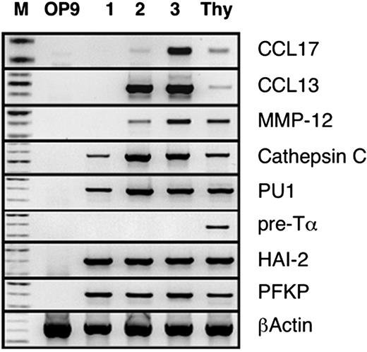 FIGURE 6. RT-PCR analysis of gene expression in H1 cells obtained after first (1), second (2), and third (3) steps of culture. Human thymus RNA (Thy) was used as positive control. Transcripts of studied genes were not amplified from OP9 cells alone. M indicates DNA markers.