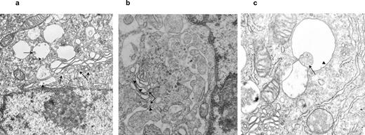 FIGURE 1. D2V enters endocytic vacuoles in human pDCs. D2V (MOI = 10) was adsorbed to purified human pDCs × 1 h at 4°C, warmed to 37°C × 5 min, and then fixed with glutaraldehyde. a, Enveloped D2V particles (arrows) in cytoplasm or small endocytic vesicles, and in larger endocytic vacuoles. b, D2V particles (arrows) in close association with Golgi apparatus and smooth ER (arrowheads). c, D2V particles (arrow) entering a large endocytic vacuole with Golgi/smooth ER membrane characteristics (arrowhead). Original magnification, ×21,000 (a and b) and ×52,000 (c).