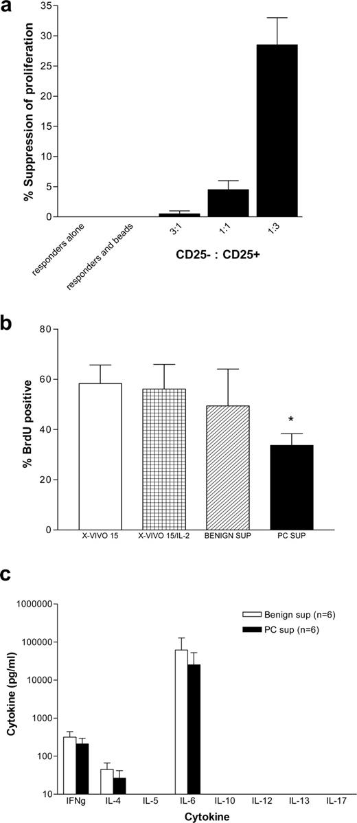 FIGURE 4. CD4+CD25+ T cells isolated from the peripheral blood of PC patients and PC tissue culture supernatants suppress T cell proliferation in vitro. a, CD4+CD25− T cells were stained with 1 μM CFSE, stimulated with CD3/CD28 beads, and cultured in the presence of the indicated ratio of CD4+CD25+ T cells (n = 2). Suppression of proliferation was calculated as percentage of the decrease in CFSE mean fluorescence intensity produced by the responders plus beads sample. b, CD4+CD25− T cells were stimulated with CD3/CD28 beads, cultured in tissue culture supernatants from benign or PC tissue (n = 4), and proliferation was assessed by measuring BrdU incorporation. Proliferation of CD4+CD25− T cells in the presence of PC supernatant was significantly inhibited compared with control (X-VIVO medium with 20 U/ml IL-2) (Student’s paired t test; ∗, p < 0.05). c, Bio-Plex assay for the measurement of multiple cytokines present in benign (□) and tumor (▪) culture supernatant (n = 6).