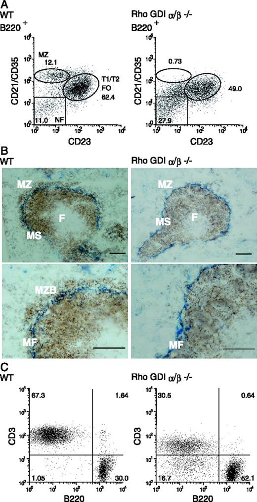 FIGURE 2. Reduction of splenic MZ B cells and accumulation of MLN B cells from Rho GDIαβ−/− mice. A, Expression of CD21/CD35 and CD23 on B220+ splenic B cells from WT and Rho GDIαβ−/− mice at 12 wk of age. Gates identify MZ B cells (CD21/CD35+CD23−) and other B lineage cells (CD21/CD35−CD23− and CD21/CD35+CD23+). Dot plots of B200+-gated cells in representative samples are shown (n > 3), and numbers represent percentages of NF, MZ, T1/T2 stage (T1/T2), and FO B cells. B, Immunohistochemistry of spleen sections stained with Abs for MOMA-1 (blue) and B220 (red). The MZ is the part of the parenchyma that lies between the white and red pulps of the spleen. The positions of the FO zone (F), marginal sinus (MS), and MZ are shown in the upper panels. MZ B cells (MZB) and MZ macrophages (MF) are shown in the lower panels. Scale bars, 200 μm. MZ B cells are colocalized with MOMA-1-positive macrophages surrounding B cell follicles of the white pulp in WT mice (left), but are scarce in Rho GDIαβ−/− mice (right). C, Lymphocytes of MLN from WT and Rho GDIαβ−/− mice at 23 wk of age are divided into the CD3+ T cells and B220+ B cells. T cell numbers as well as expression levels of CD3 are reduced in Rho GDIαβ−/− mice compared with WT mice, while B cell proportion is increased in Rho GDIαβ−/− mice.