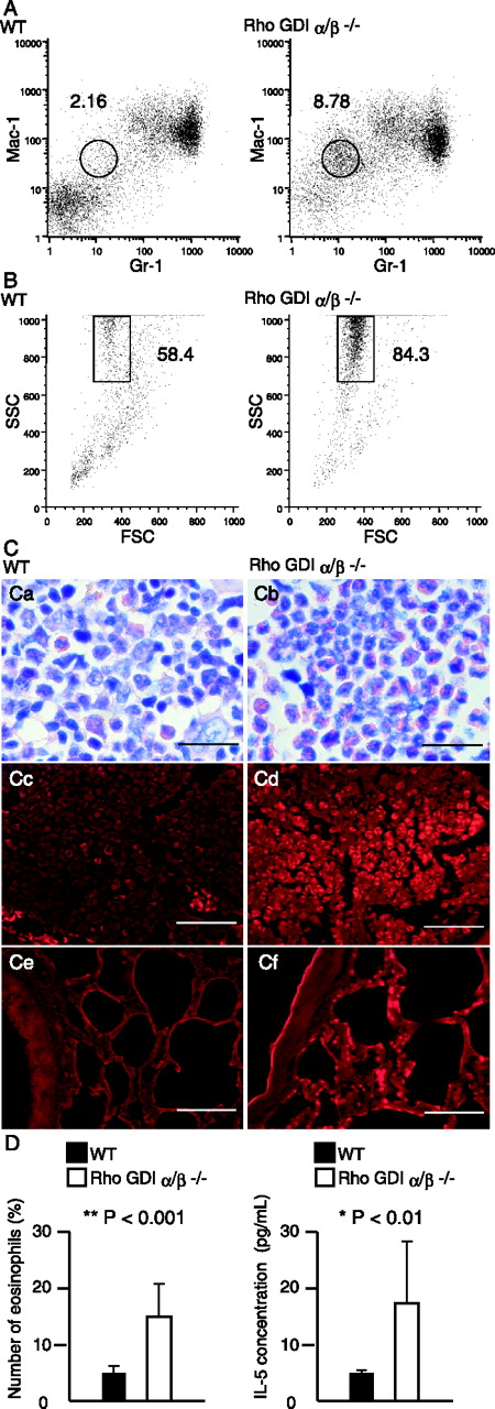 FIGURE 4. Increased eosinophil numbers in the BM and lung of Rho GDIαβ−/− mice. A, BM cells are prepared from WT and Rho GDIαβ−/− mice at 23 wk of age, and then analyzed for surface expression of the myeloid lineage markers, Mac-1 and Gr-1, by flow cytometry. B, The BM cell population indicated in A is further analyzed for SSC related to the cell granularity and forward scatter (FSC) related to the cell size by flow cytometry. C, BM sections from WT (a) and Rho GDIαβ−/− (b) mice at 32 wk of age are stained with H&E. BM sections from WT (c) and Rho GDIαβ−/− (d) mice at 32 wk of age are stained with the EoProbe kit, which is indicative of eosinophil-specific granules. Lung sections from WT (e) and Rho GDIαβ−/− (f) mice at 32 wk of age are stained with the EoProbe kit. Scale bars, 20 μm (a and b) and 50 μm (c–f). D, Relative eosinophil numbers in the BM and serum IL-5 concentrations are compared between WT and Rho GDIαβ−/− mice at 6–55 wk of age (WT, n = 35; Rho GDIαβ−/−, n = 37). ∗, p < 0.01; ∗∗, p < 0.001.