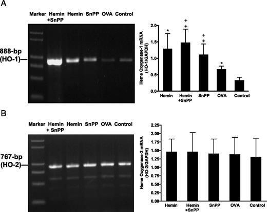 FIGURE 4. A, The expression of HO-1 mRNA in lung tissue was detected by RT-PCR (day 28). The levels of HO-1 mRNA in lung tissue were significantly higher in both OVA and hemin groups than control mice (∗, p < 0.05). Pretreatment with SnPP or hemin plus SnPP also increased the expression of HO-1 mRNA in comparison with OVA-treated mice (‡, p < 0.01). B, The expression of HO-2 mRNA in lung tissue was detected by RT-PCR (day 28). The level of HO-2 mRNA was similar across all groups. Error bars, SD.